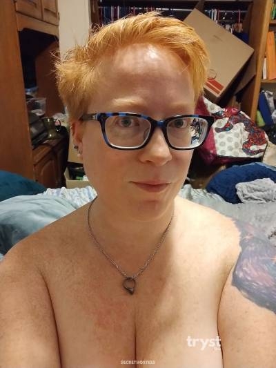Bara,21Yrs Old Escort Unicov